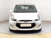 Hyundai ix20, 2011 - pohled č. 2