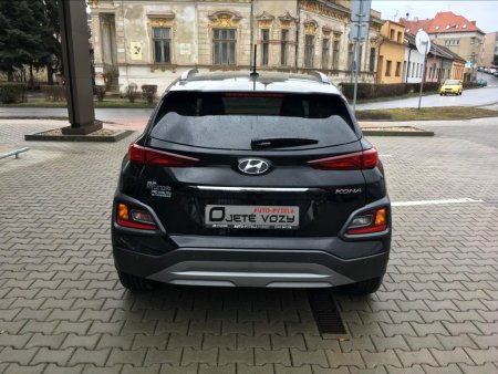 Hyundai Kona, 2018 - pohled č. 5