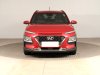 Hyundai Kona, 2018 - pohled č. 2