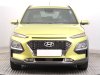 Hyundai Kona, 2017 - pohled č. 2