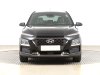 Hyundai Kona, 2019 - pohled č. 2